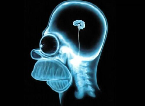 Cartoon character skull X-ray with small brain.