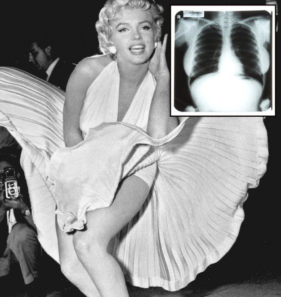 Vintage photo with chest X-ray overlay