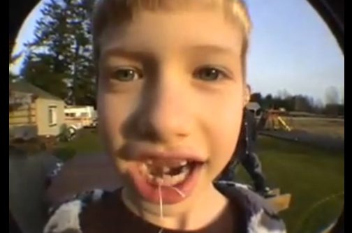 Child with missing tooth smiling outdoors