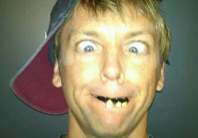 Person goofing around with crossed eyes