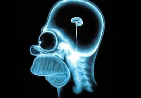 Cartoon character skull X-ray with small brain.