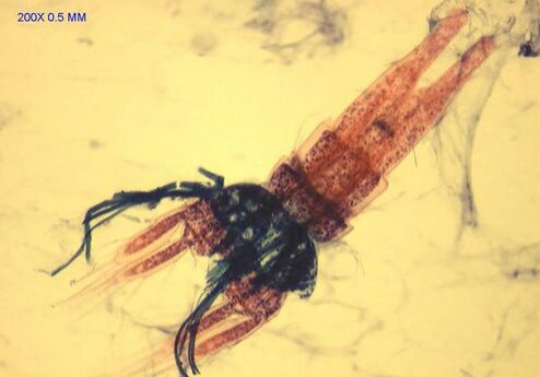 200x zoom on a microscopic subject