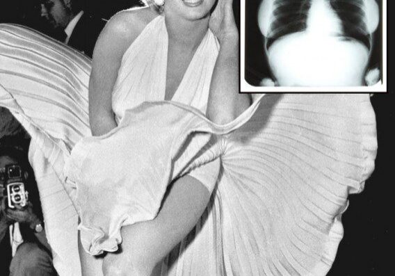 Vintage photo with chest X-ray overlay