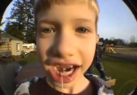 Child with missing tooth smiling outdoors